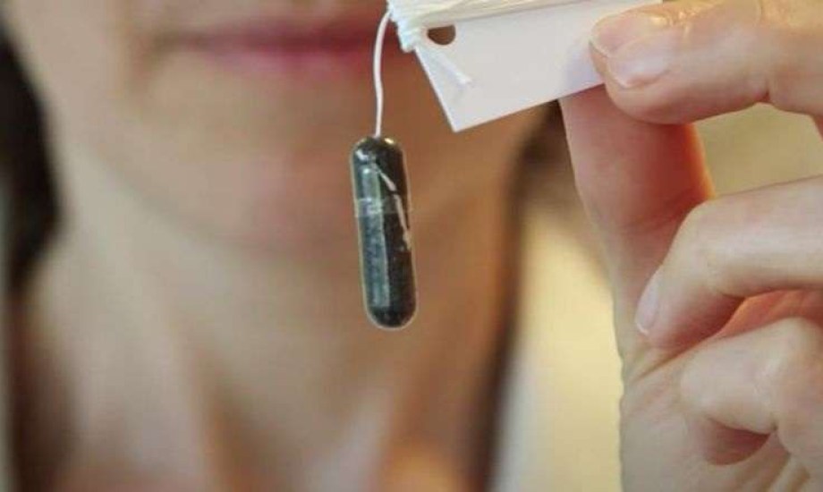 كبسولة الإسفنجة تحدد خطر الأورام في مريء باريت