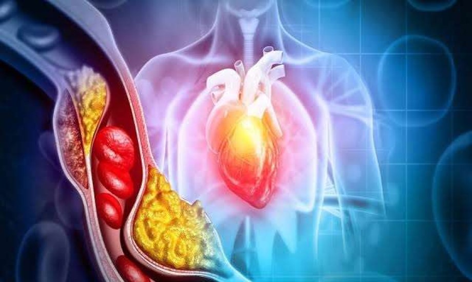 عوامل تؤثر على مستوى الكوليسترول