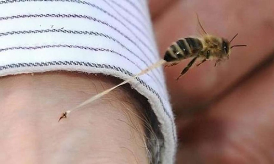 ماذا تفعل إذا لسع طفلك نحلة؟