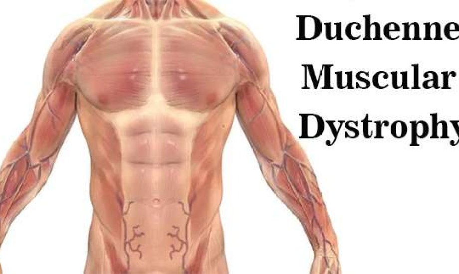 لماذا رفضت الـFDA دواء Deramiocel لعلاج ضمور العضلات الدوشيني؟