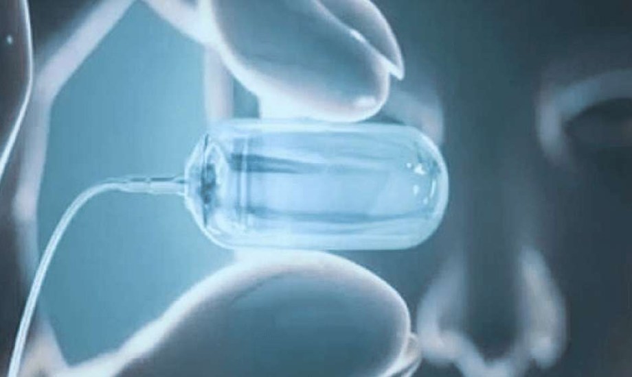 وداعا للمنظار المزعج.. كبسولة ذكية تكشف أورام الحلق بسهولة