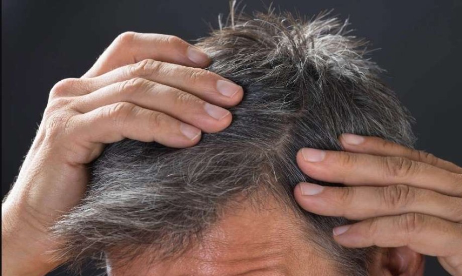 العلماء يحددون الخلايا المسؤولة عن الشيب والصلع