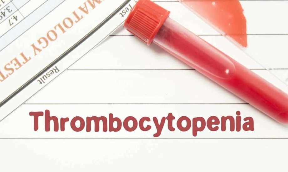 دواء جديد بأشكال متعددة ينقذ الأطفال من نقص الصفائح الدموية