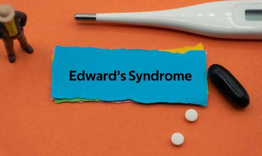 التثلث الصبغي 18.. كيف تكتشفين إصابة جنينك بمتلازمة إدواردز؟