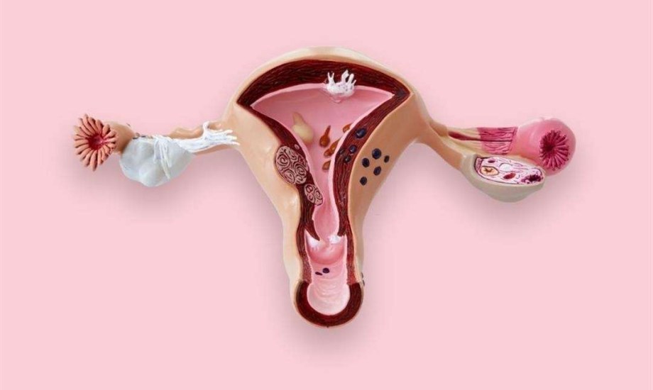 5 أطعمة تحارب نمو الأورام الليفية عند النساء