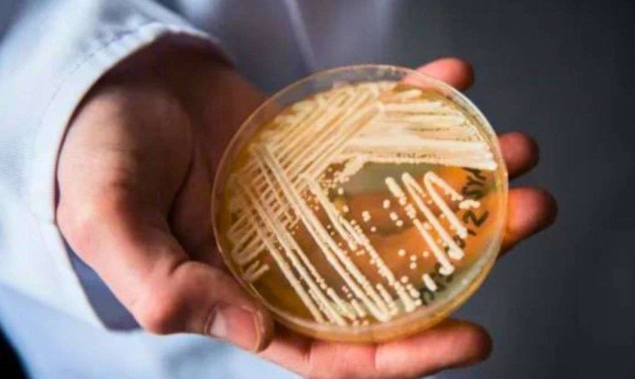 عدوى فطرية خطيرة تنتشر في المستشفيات والعيادات