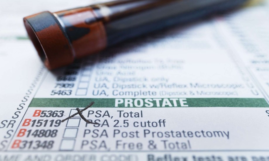 اختبار المستضد النوعي.. كيف ينبهك لعودة أورام البروستاتا؟
