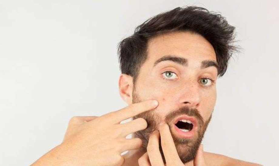 كيف تعتني ببشرتك الدهنية كرجل؟