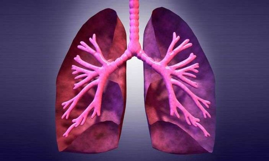 بخاخ يومي يظهر نتائج واعدة في علاج مرض رئوي نادر