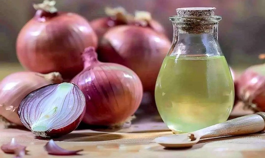 كيف أعاد عصير البصل الحياة إلى شعر نجمات بوليوود؟