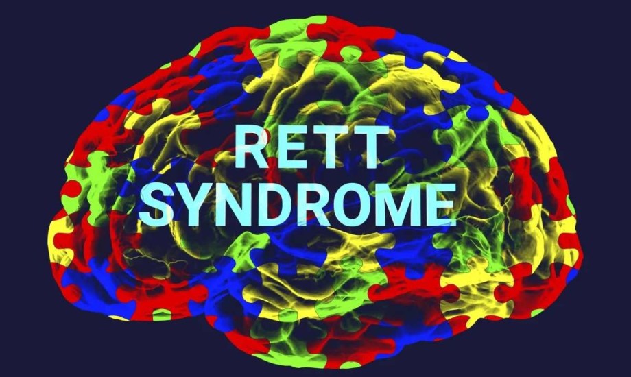 لماذا تصيب متلازمة ريت الإناث أكثر من الذكور؟
