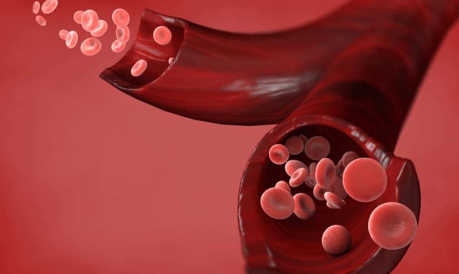 علاج محتمل لكثرة الحمر الحقيقية.. يقلل الحاجة المتكررة لسحب الدم