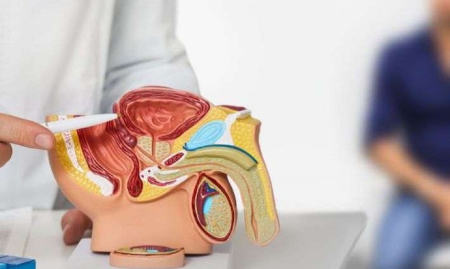 اختبار بول جديد يكشف أورام البروستاتا الخطيرة