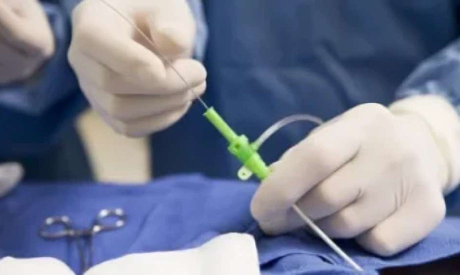 نجاح أول عملية منظار صدري لإصلاح رتق المريء لرضيع