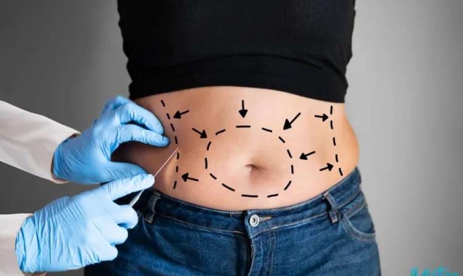  دواء تجريبي قد يغني عن جراحات السمنة