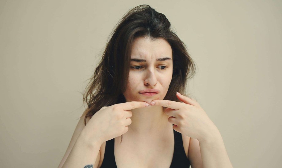 البشرة المعرضة لحب الشباب