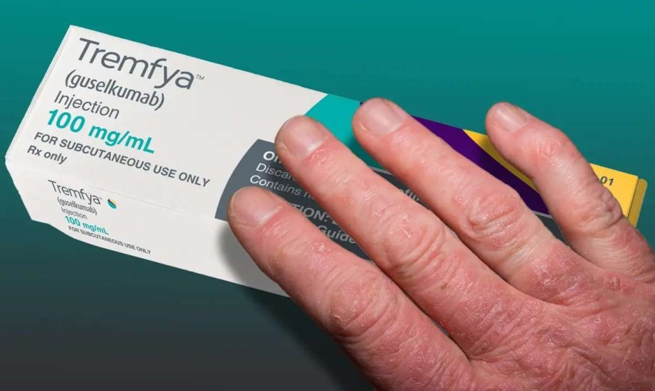 اعتماد دواء Tremfya لعلاج الصدفية والتهاب المفاصل عند الأطفال