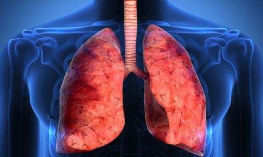 دواء Jascayd لعلاج التليف الرئوي مجهول السبب