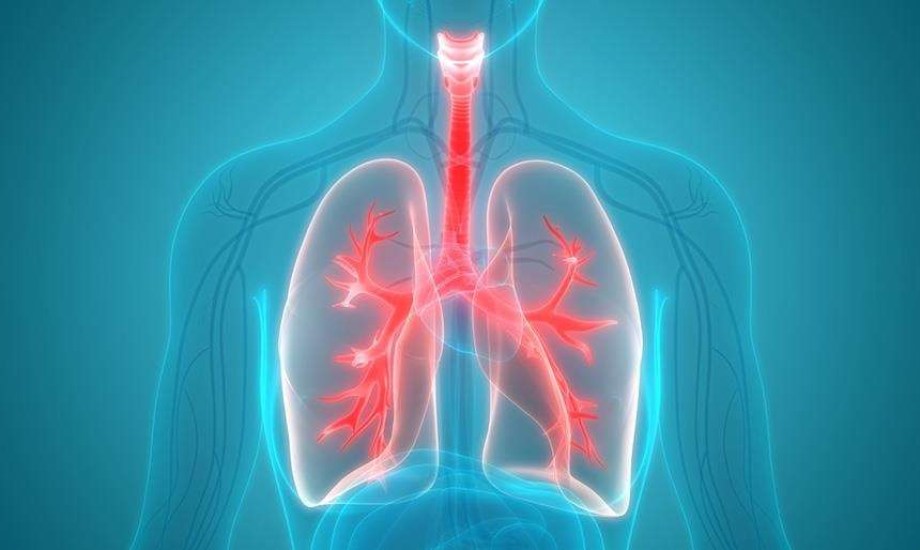 تكيس المبايض يهدد صحة الرئة