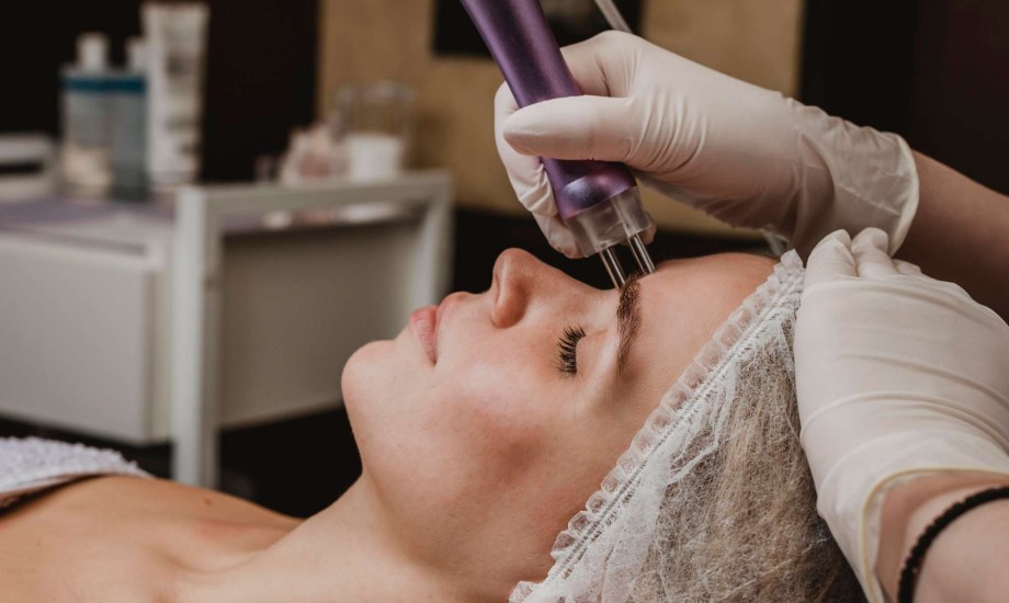 تقنية الحقن بالميكروإبر