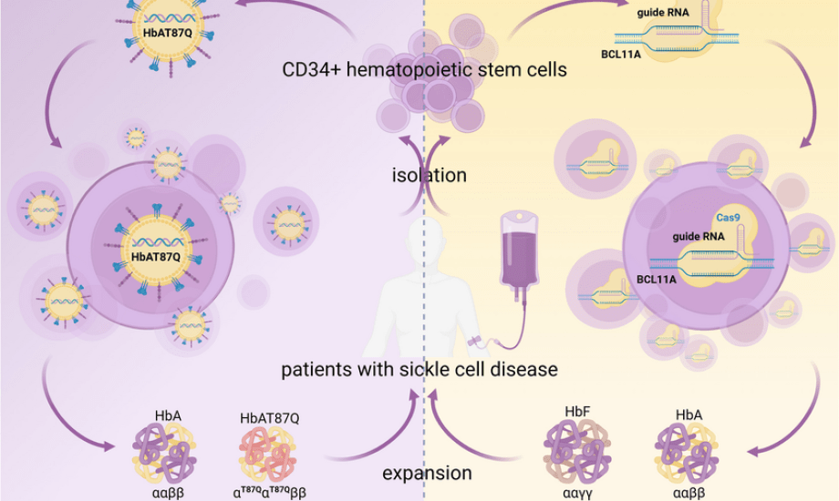أول علاجين جينيين لعلاج مرضى فقر الدم المنجلي