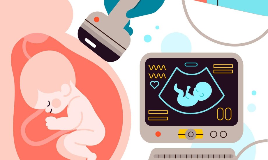 تفاعل أوعية المشيمة يكشف عن عيوب القلب الخِلقية لدى الأجنة