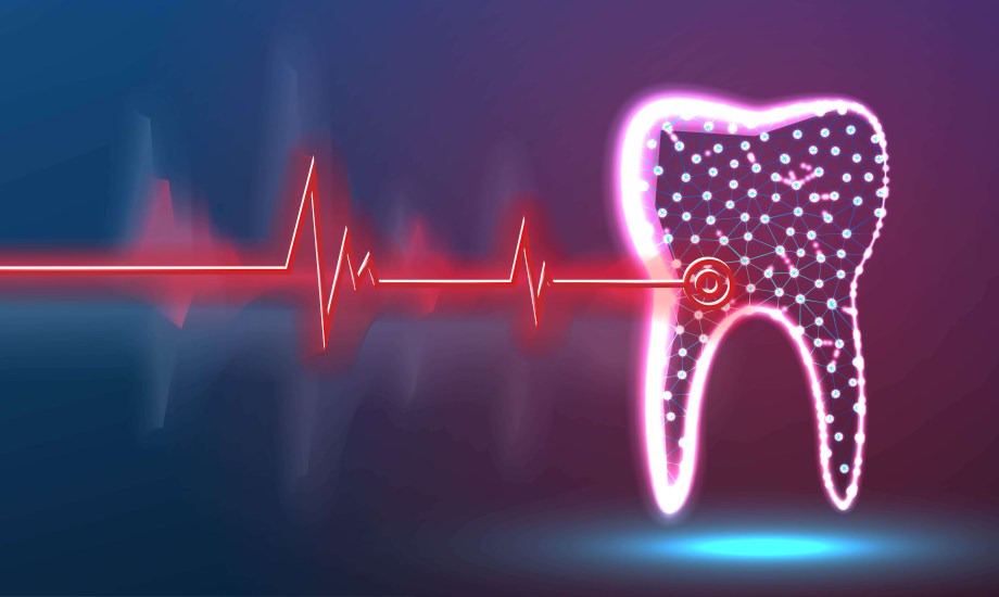 علاقة حشو عصب الأسنان بصحة القلب