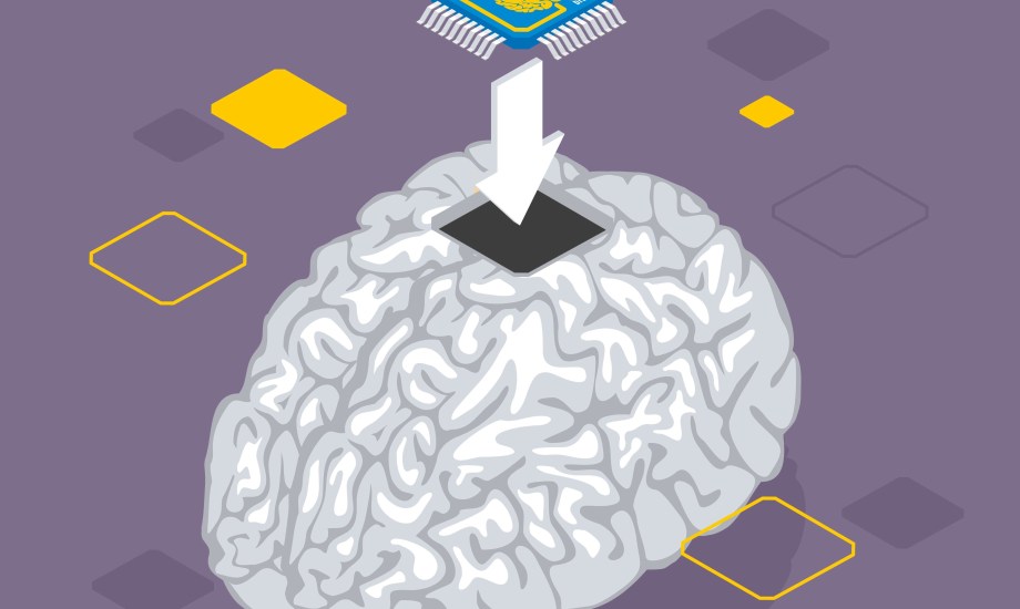 جراحة دماغية ذاتية للحصول على أحلام واضحة