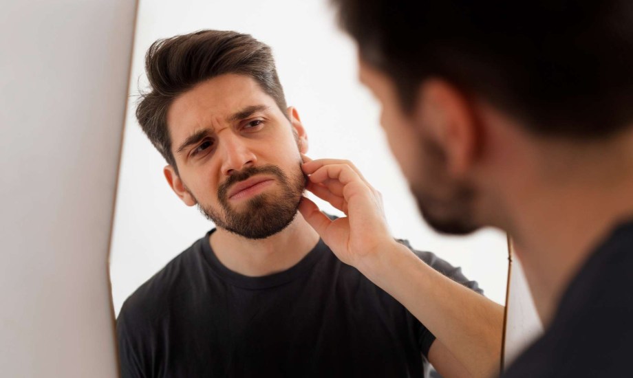 أسباب اللحية الخفيفة