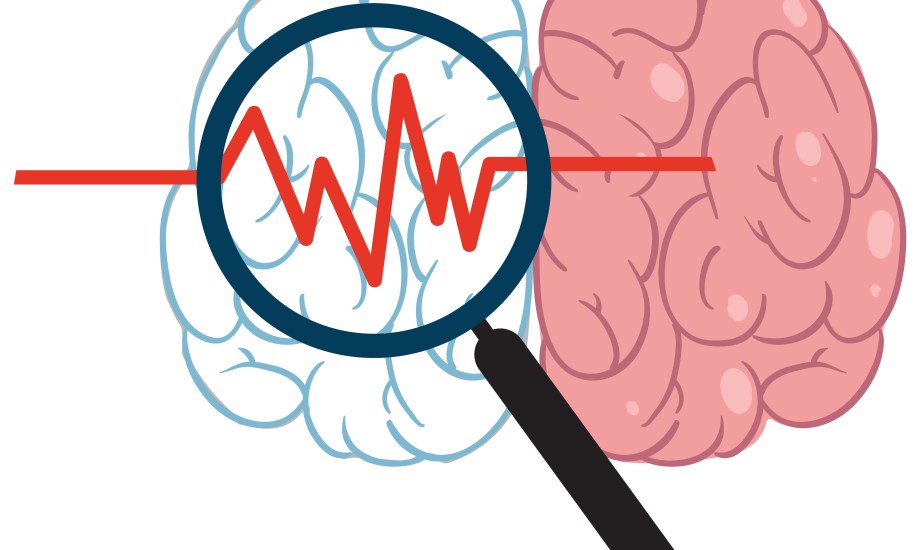 "النبضات الكهرومغناطيسية" علاج جديد لمرضى السكتة الدماغية