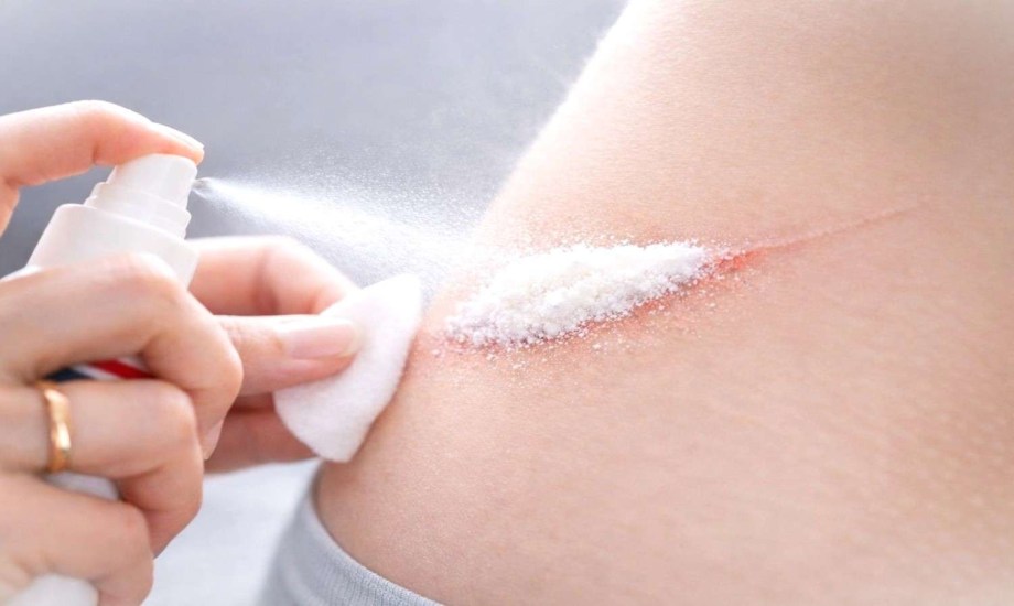 بخاخ لمعالجة الجروح