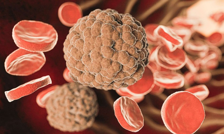 جلطات الدم بسبب لقاحات كوفيد