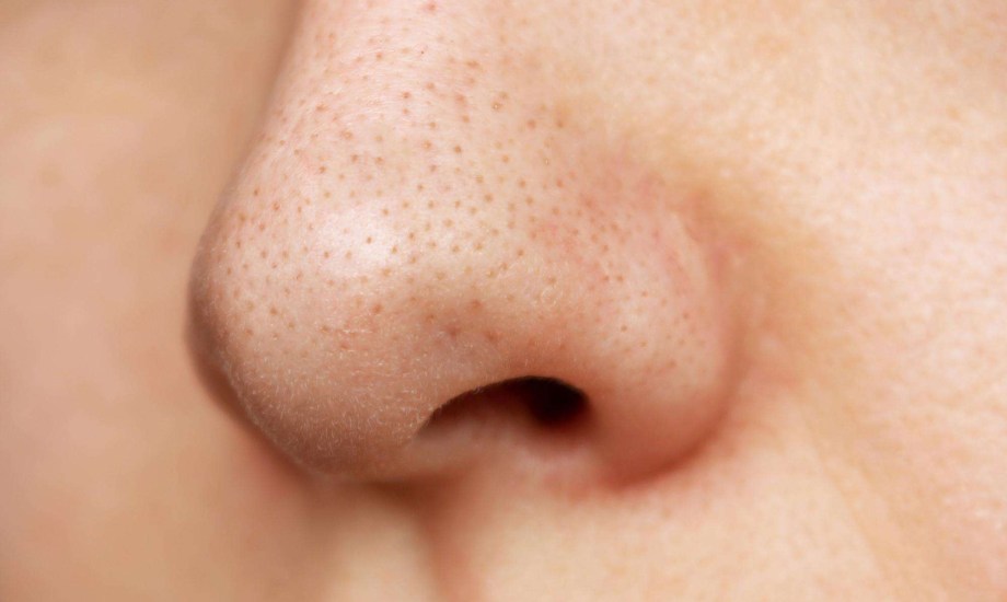 الرؤوس السوداء