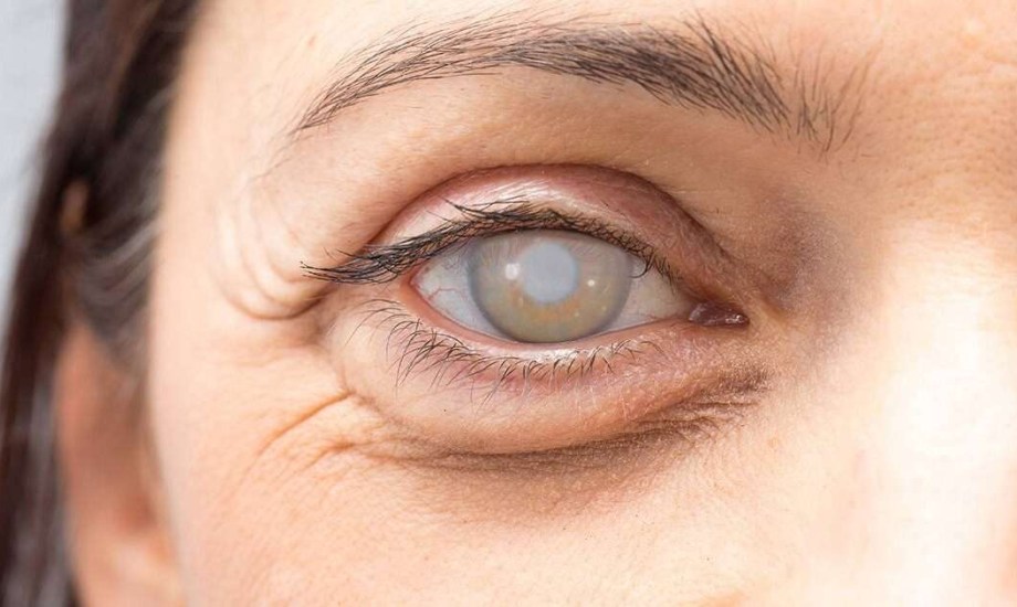 المياه الزرقاء