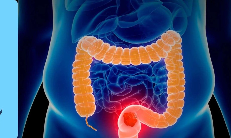 البروستاتا