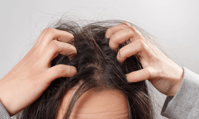 أسباب تباطؤ نمو الشعر في الشتاء وكيف تتعاملين معه