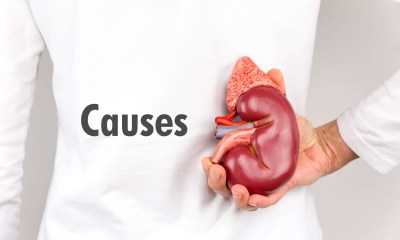 الفشل الكلوي