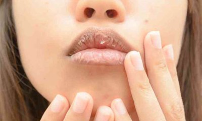 علامات على الشفاه تدل على انخفاض سكر الدم