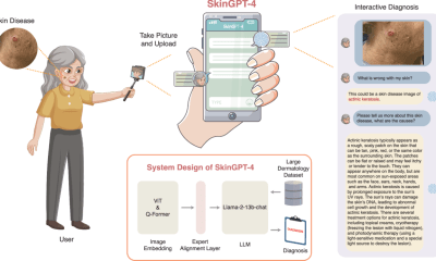 SkinGPT-4 لتشخيص الأمراض الجلدية