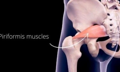أسباب وأعراض متلازمة الكمثرى