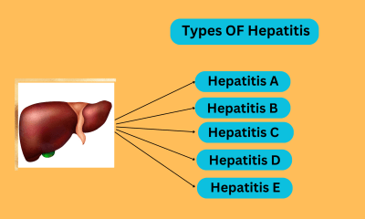 أنواع التهاب الكبد الوبائي