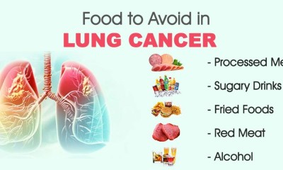 أطعمة يجب تجنبها عن مرضى سرطان الرئة