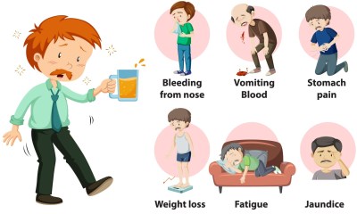 أعراض أخرى لأمراض الكبد