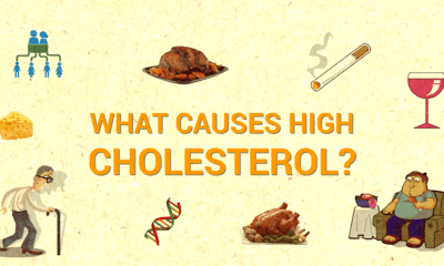 أسباب لارتفاع الكوليسترول لدى الرجال