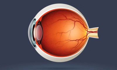 اعتلال الشبكية السكري