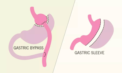أدوية إنقاص الوزن أم جراحات السمنة.. ما الأفضل؟