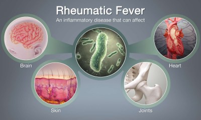الإصابة بالحمى الروماتيزمية