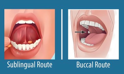 الأدوية تحت اللسان