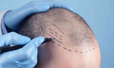 فوائد Microblading hairline