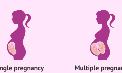 التوأم أصغر في مراحل الحمل الأولى كشفت الدراسة التي نُشرت في